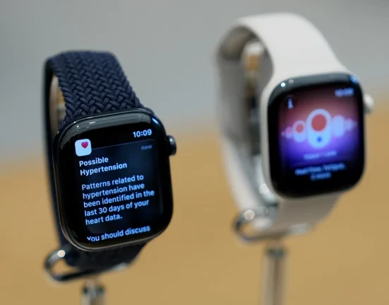 Apple Watch Series 12 : Améliorations des fonctionnalités, mais la réparation reste complexe avec les nouveaux modèles